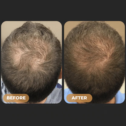 Herculean™ Hair Growth